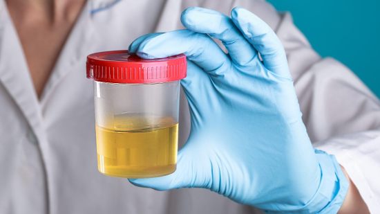 Cetonas en la orina durante el embarazo: qué es y causas principales