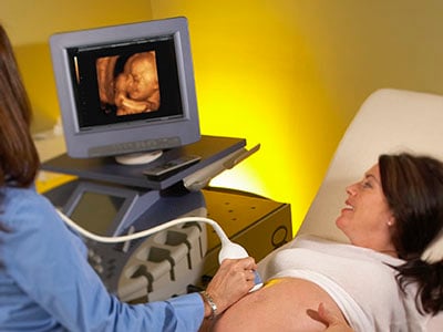 La placenta: un completo suministro para tu bebé