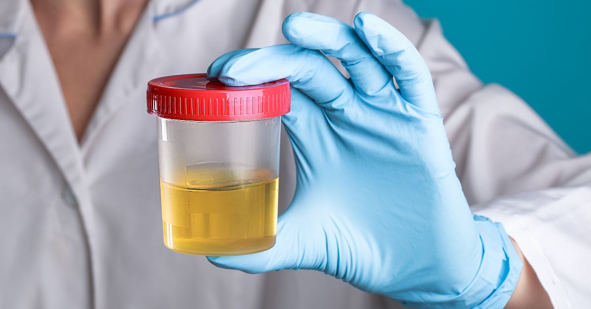 Urocultivo en el embarazo: qué es y para qué sirve