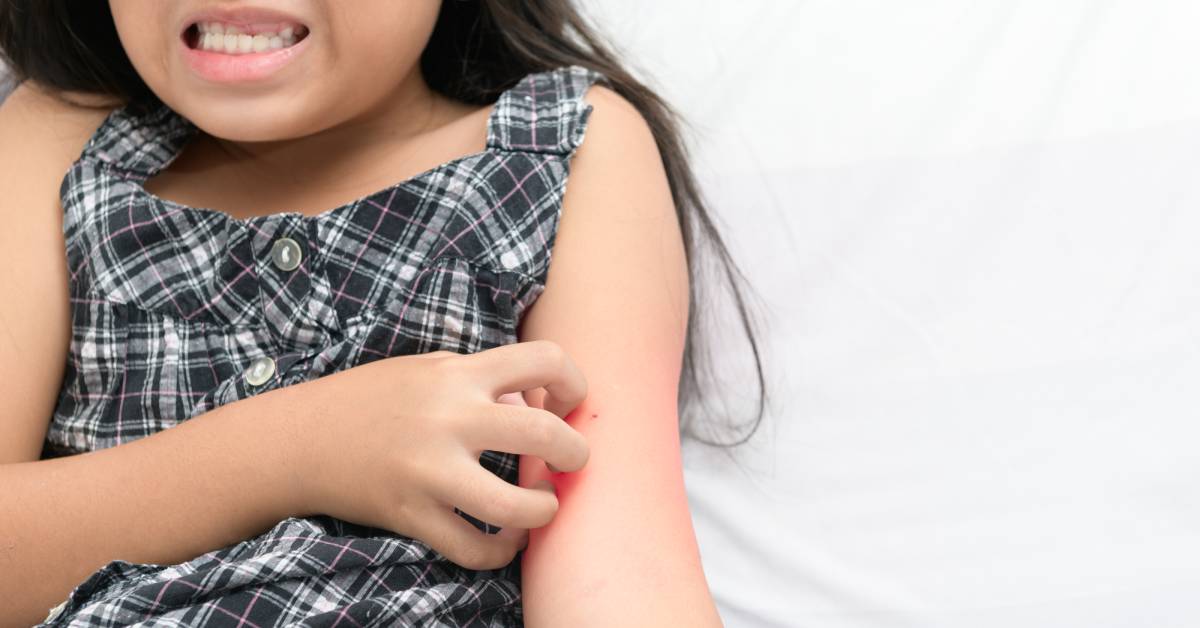 Mi hijo se pellizca la piel: ¿qué es la dermatilomanía?