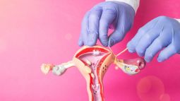 Se puede revertir la ligadura de trompas