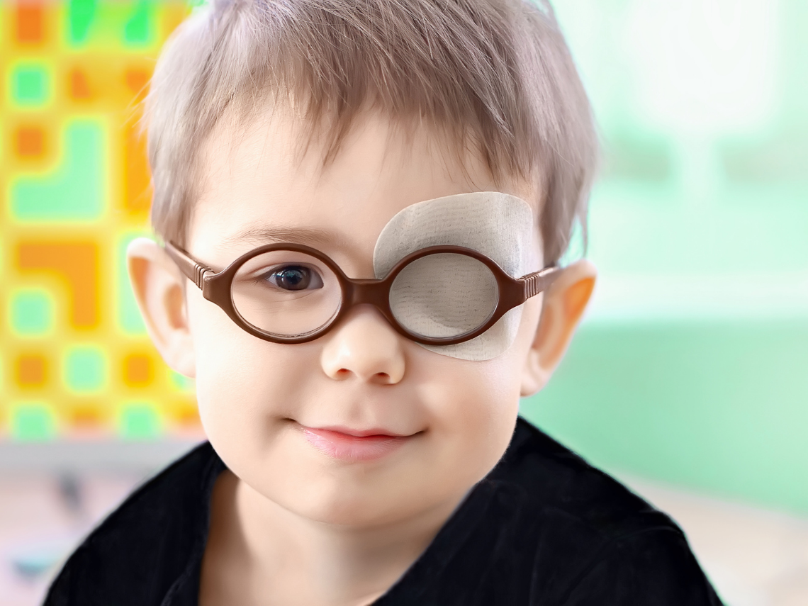 El estrabismo puede perjudicar la salud mental de los niños
