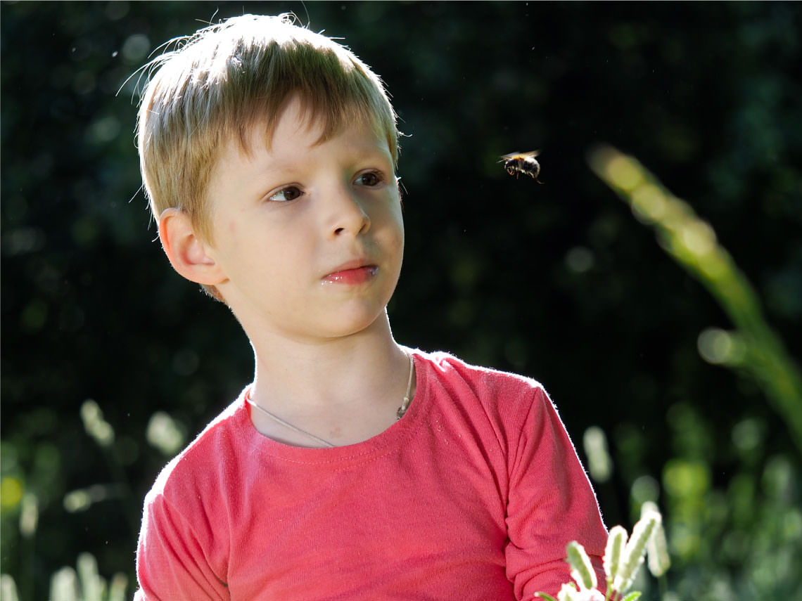 Cómo tratar una picadura de abeja en niños