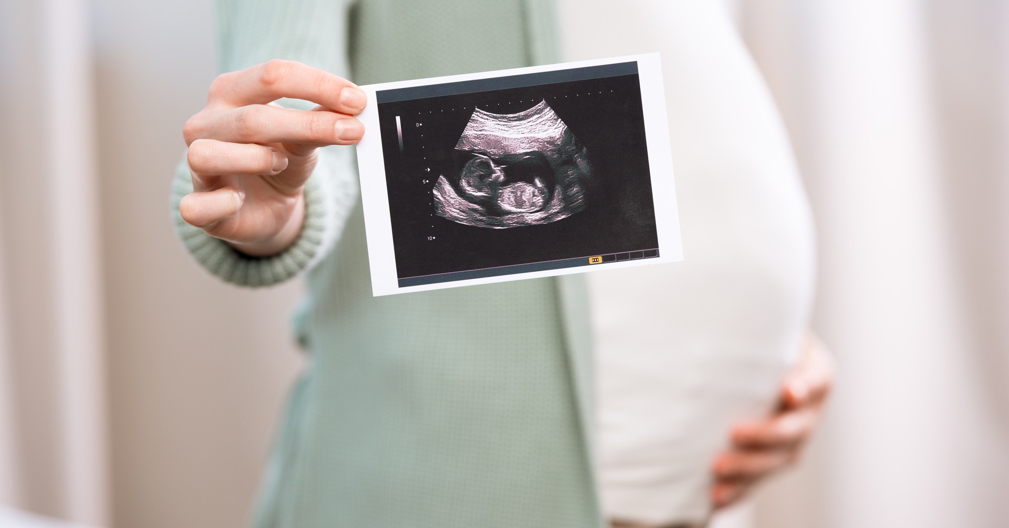 ¿Es posible conocer el sexo del bebé en la primera ecografía?