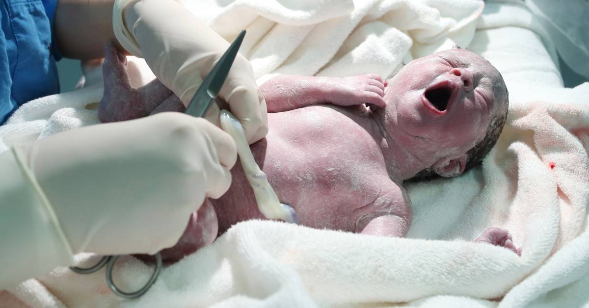 Prolapso de cordón umbilical: causas y riesgos