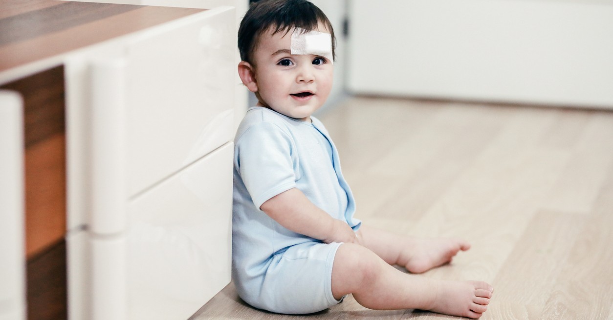 Cómo tratar las cicatrices en los niños
