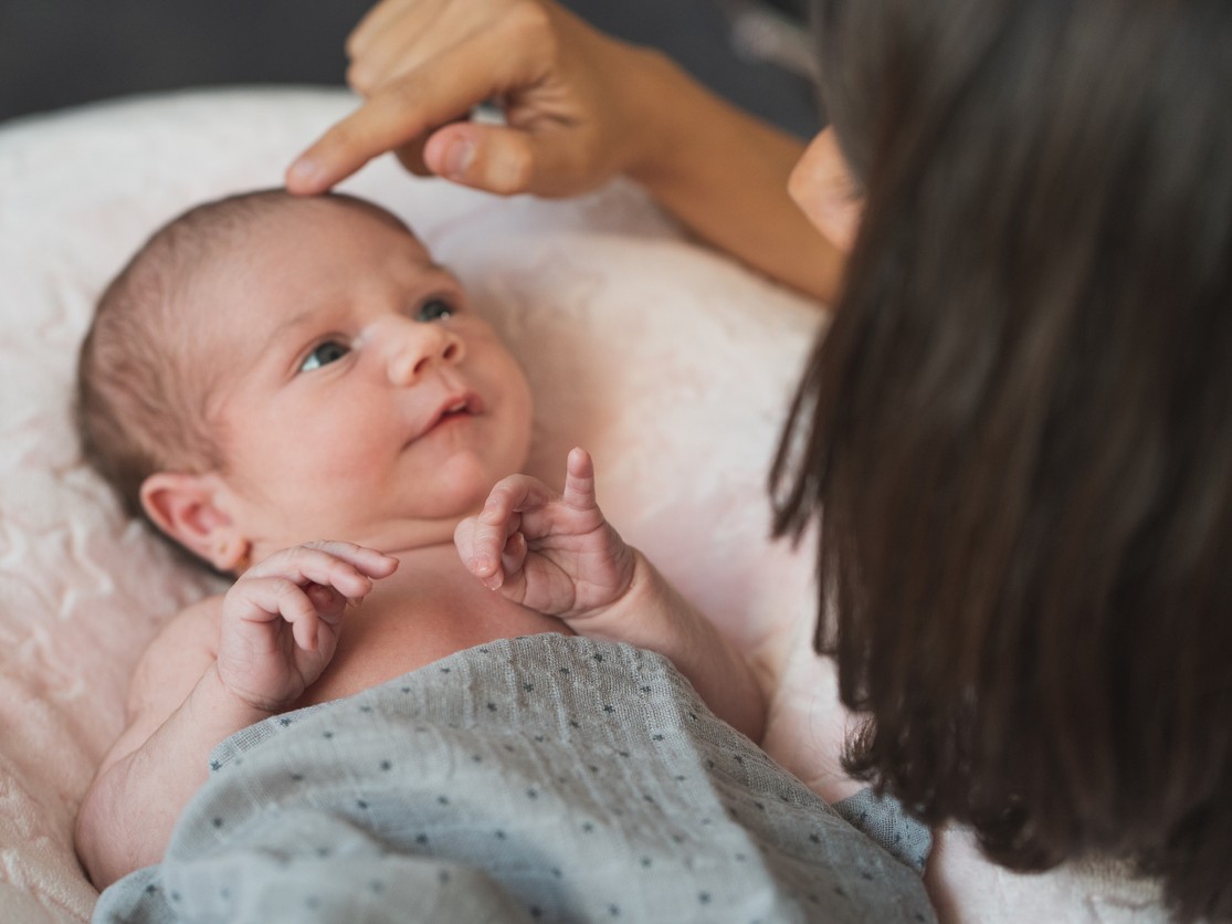 Bebé con costra láctea (Foto: iStock)