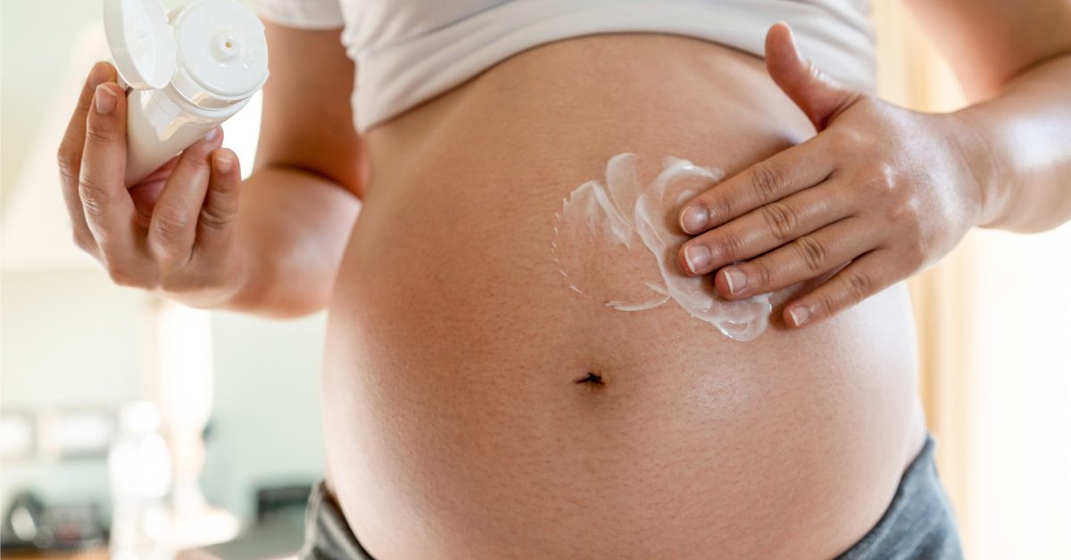 Cremas antiestrías para embarazadas: todo lo que debes saber