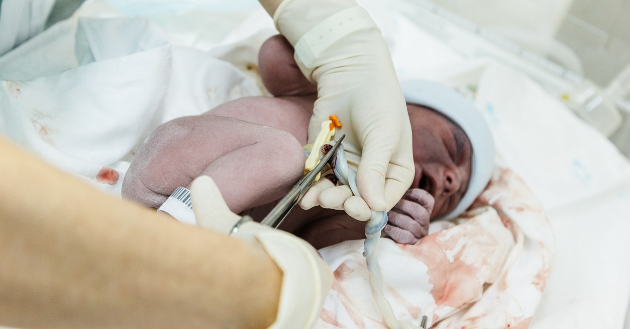 Cómo cortar el cordón umbilical y qué precauciones se deben tener