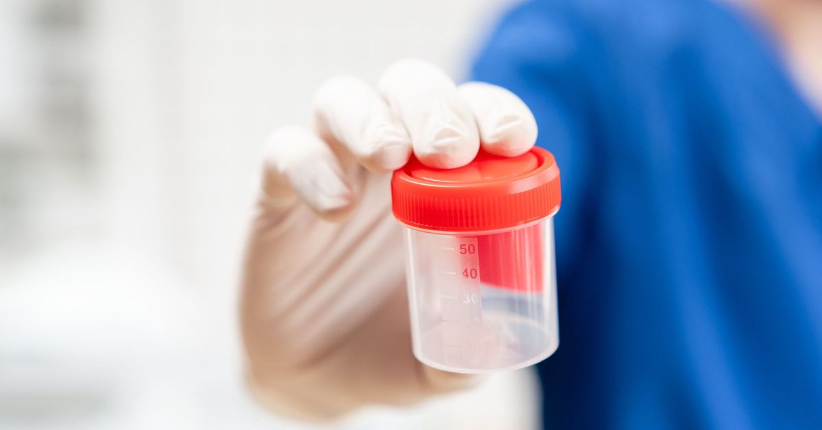 En qué consiste la hipospermia, causas y tratamiento