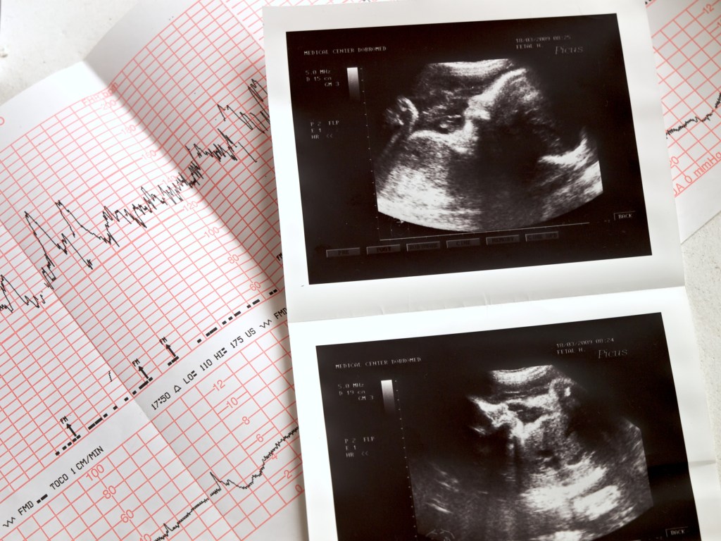 Estos son los percentiles del crecimiento fetal en cada semana del embarazo