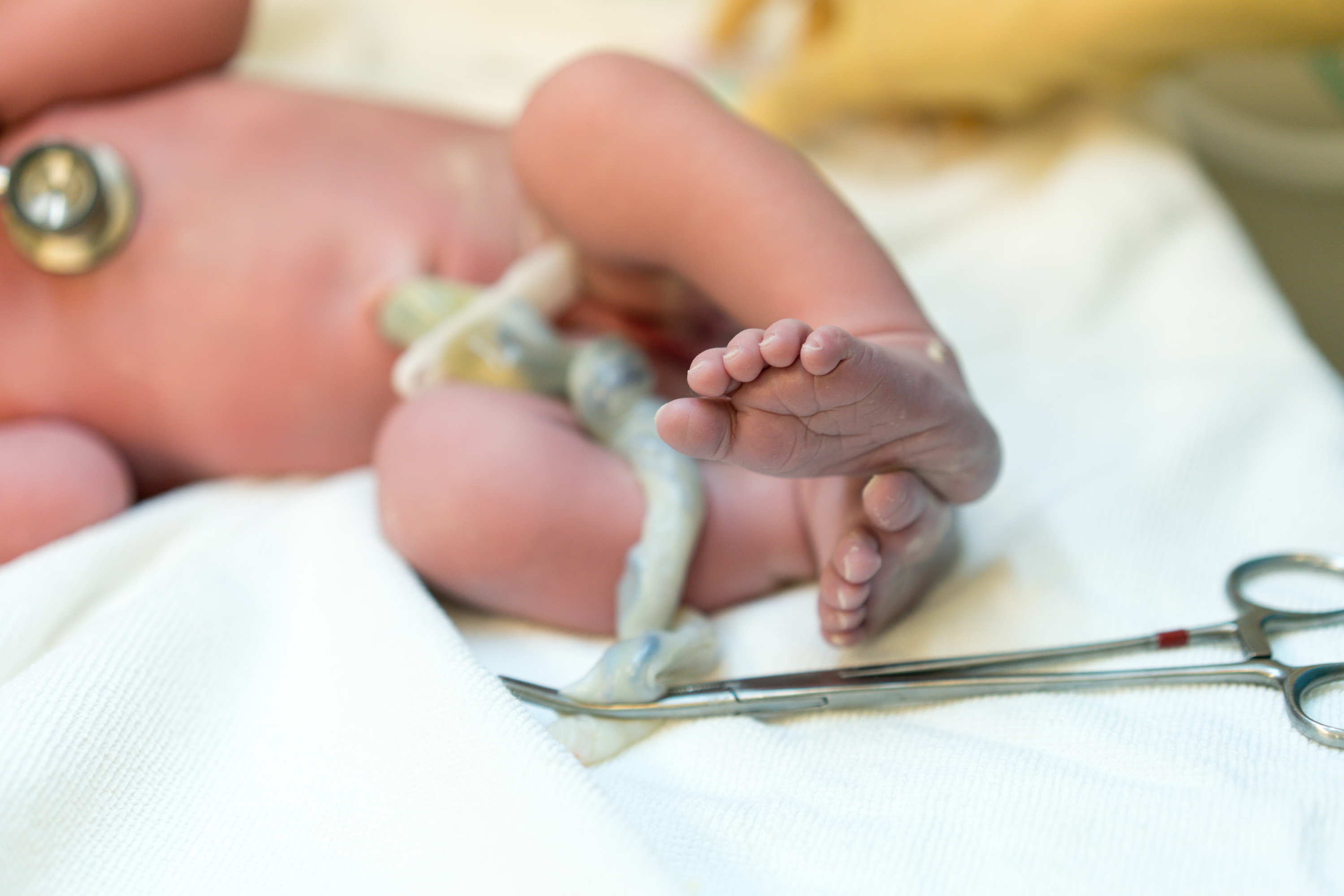 cordón umbilical