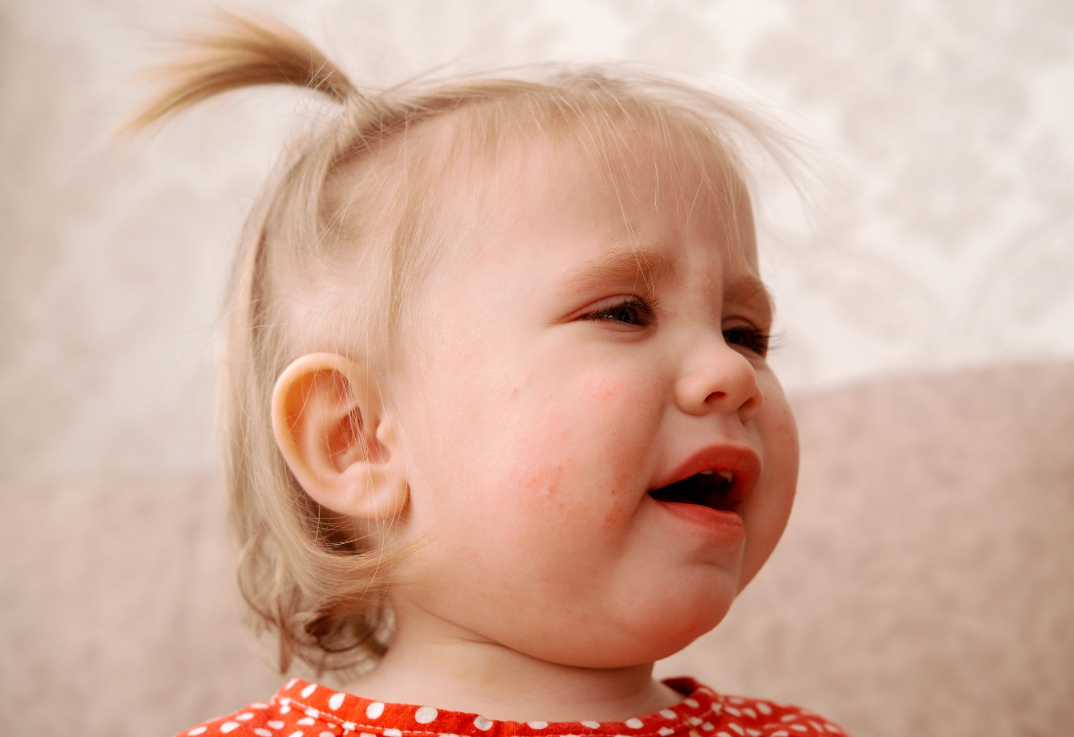 roseola
