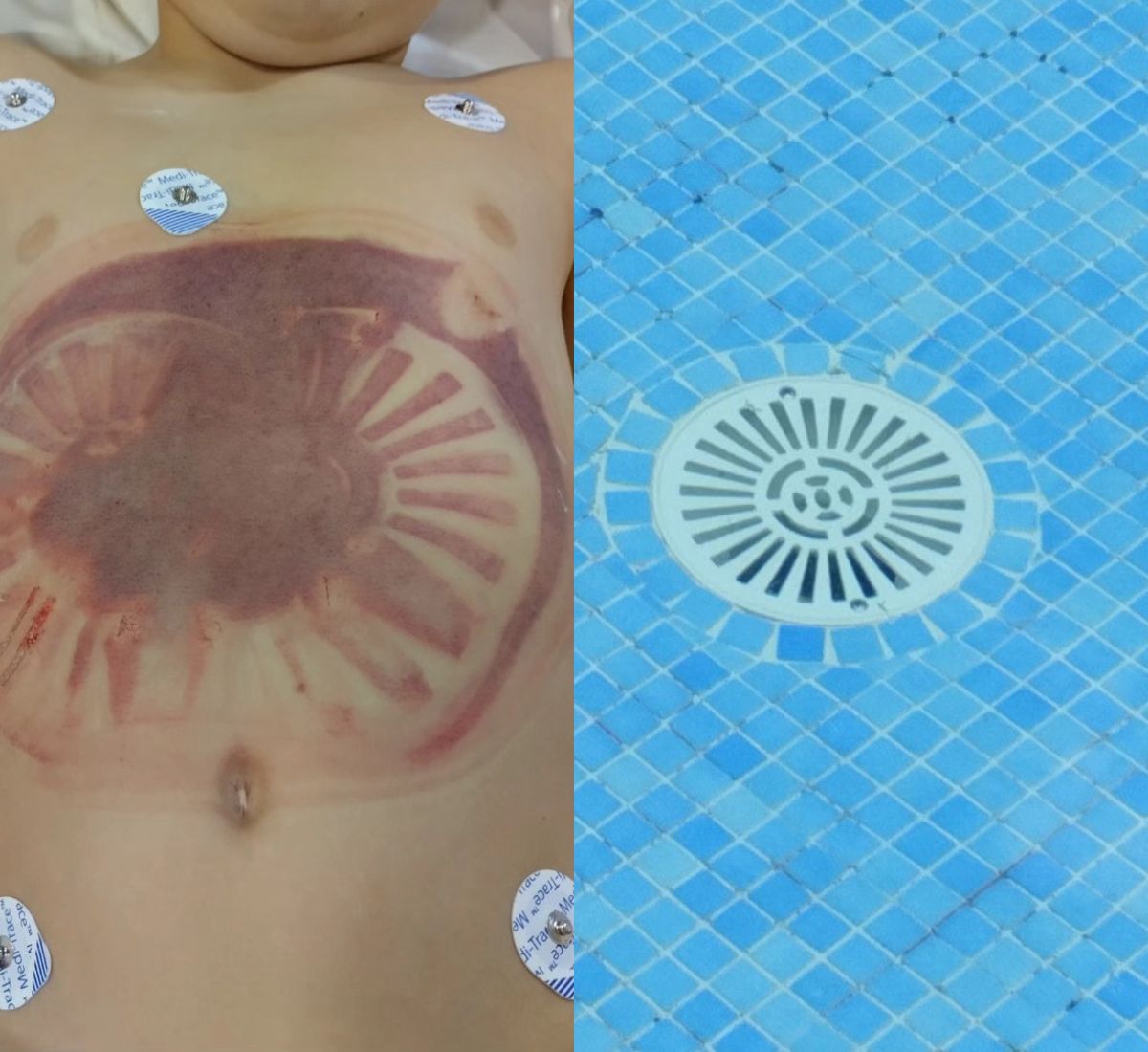 succionador piscinas