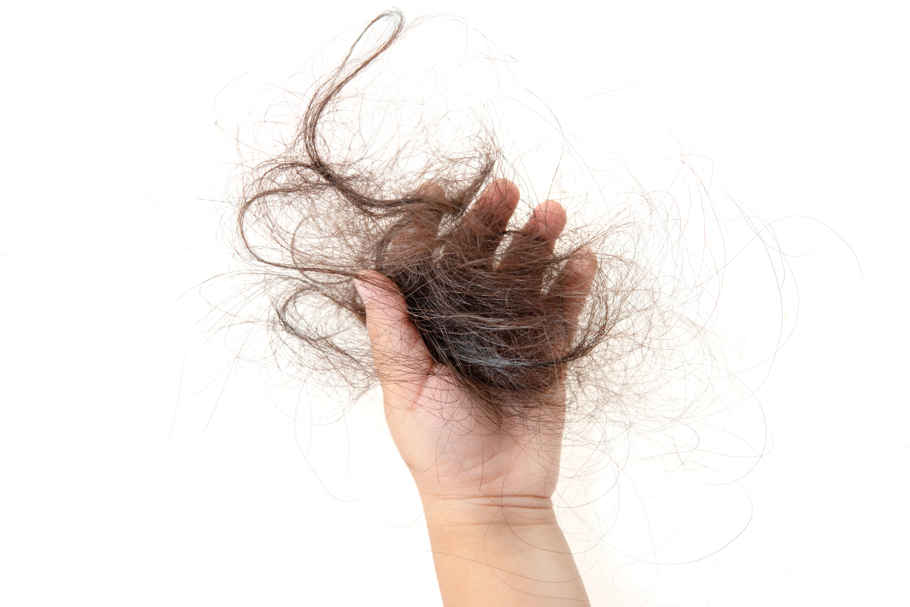caida pelo