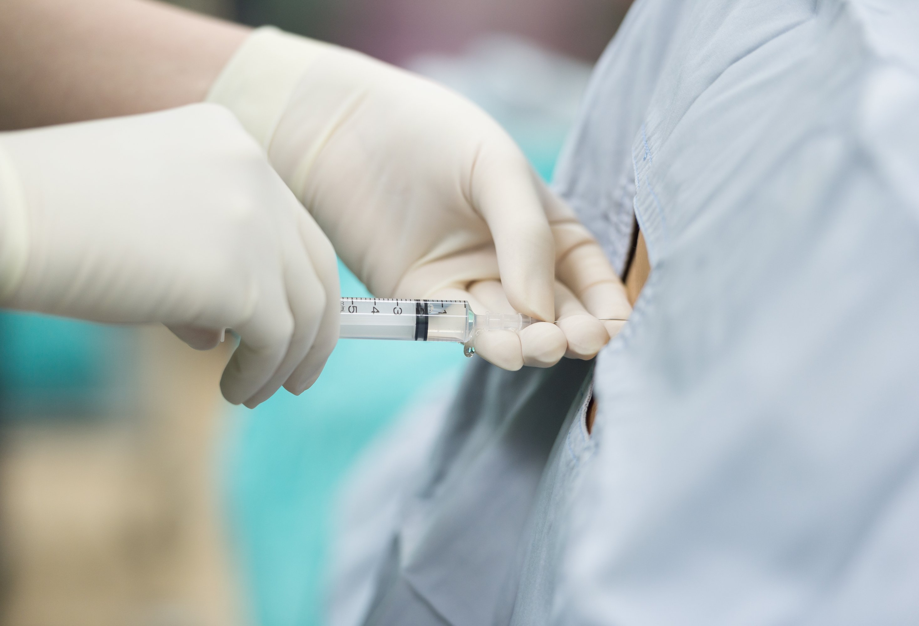 Walking epidural