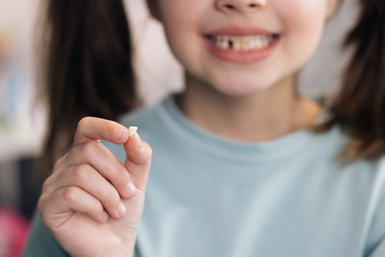 Dientes de leche