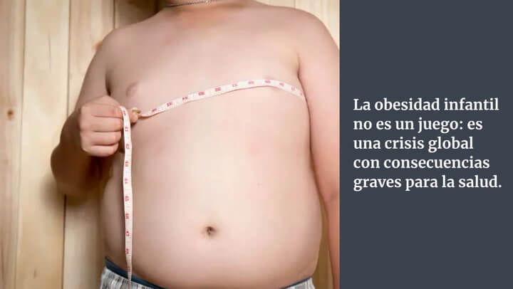 La obesidad infantil es una amenaza y los padres tienen la culpa