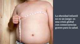 La obesidad infantil es una amenaza y los padres tienen la culpa