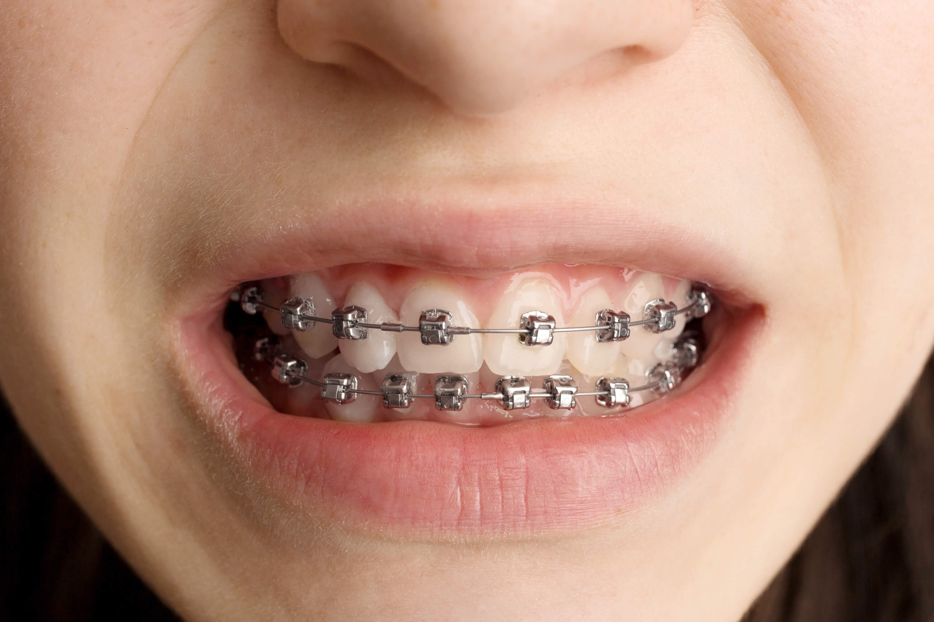 iStock-1316114867