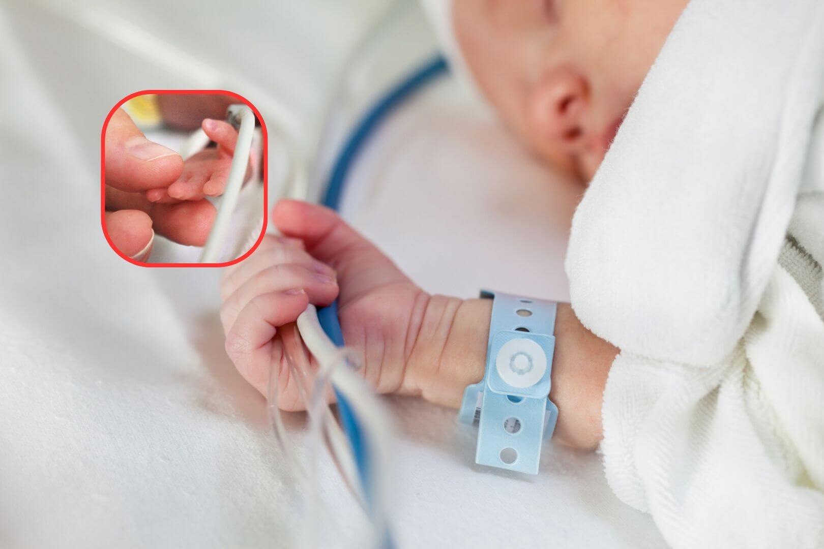 El contacto entre madre e hijo en los primeros días de vida es clave para el desarrollo del bebé, incluso en situaciones médicas complejas como la prematuridad (iStock. Composición RG)