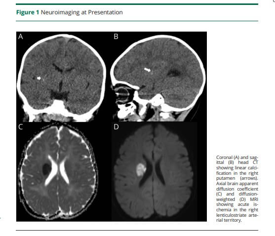Figura 1 Neuroimagen en la presentación